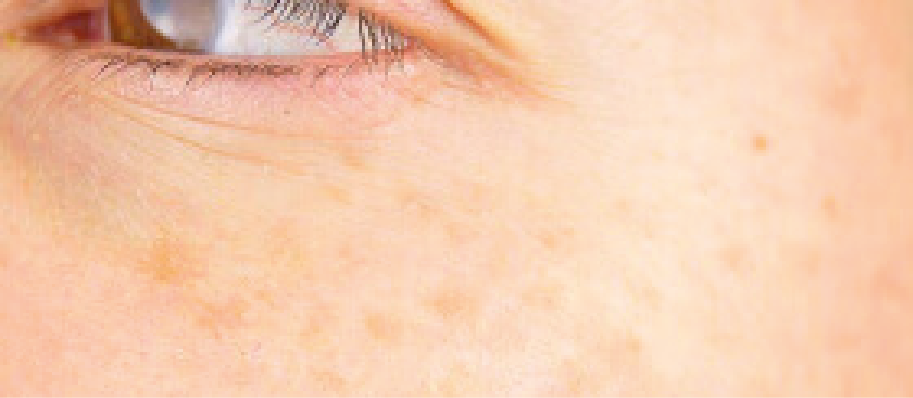 PECAS